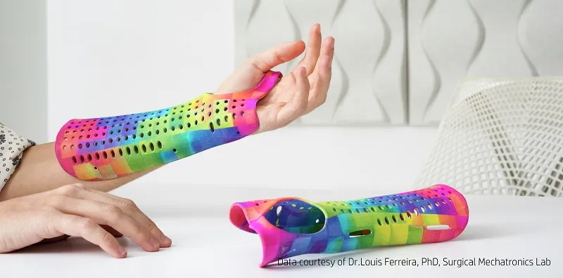 Full-color 3D printed prosthetics